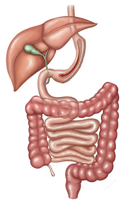 Gastrectomia Vertical (ou Sleeve Gastrectomy)